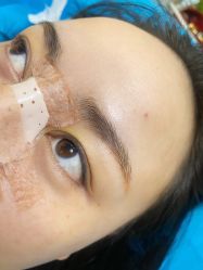 点击看大图 体验前-重庆联合丽格第五医疗美容医院