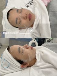 -慕颜医疗美容·皮肤微整 抗衰