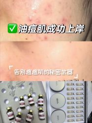 -SKIN79皮肤管理中心