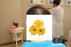 -大麦微针植发丨全国连锁