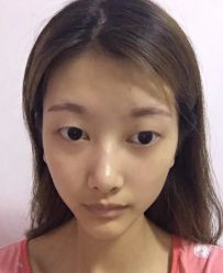 -广东韩妃整形外科医院