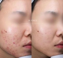 -禾壹净·素颜美问题肌肤修护中心