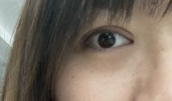 -天津健丽·去眼袋医疗美容机构