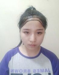 -新生植发·植养护一体