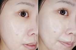 -SKINIST丽铂医疗美容
