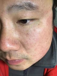 -美人痣全国连锁