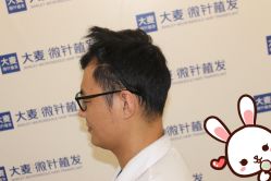 点击看大图 -大麦微针植发丨全国连锁