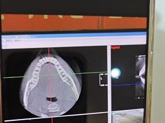 -土豆口腔(凤凰北总店)