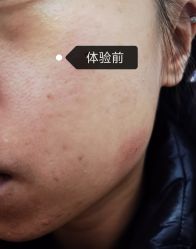 体验前-正璞医疗美容·皮肤修复·微整注射