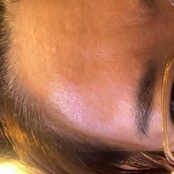 体验前-南京医科大学友谊整形外科医院