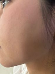 -广州美莱医疗美容医院