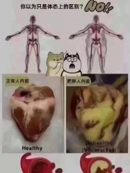 -香薇妮丝女子减肥院