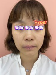 体验前-Dr.U博士医疗美容医院