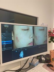 -苑苑vbeauty科技美容SPA