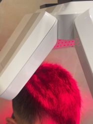 -碧莲盛·不剃发植发