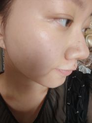 -成都西区医院整形美容