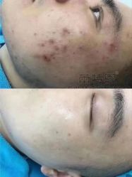 -蕾特恩专业祛痘·皮肤管理