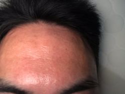 体验后-重庆军科整形美容医院