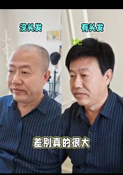 -唐风采假发补发定制