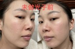 -江油茗汇整形医院