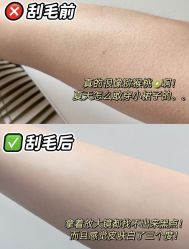 -植蔻妍倍儿专业脱毛·皮肤管理