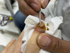 -新甲连锁灰指甲·甲沟炎·鸡眼(黑龙江路店)