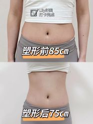 点击看大图 -Lily纤美·科技减脂中心