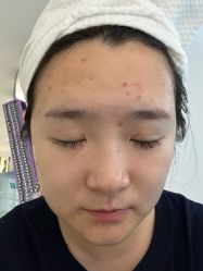 -小忠丽格医美