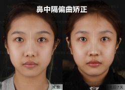 -北京米扬丽格医疗美容·联合丽格鼻整形中心