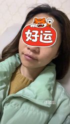 体验后-南京医科大学友谊整形外科医院