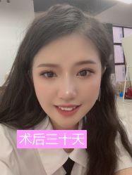 -广州健丽·去眼袋医疗美容机构