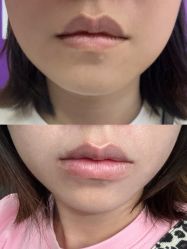 -厦门美莱整形美容医院