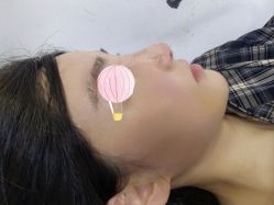 -杭州美莱医疗美容医院