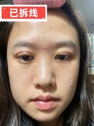 -素美医疗美容·西南眼鼻整形·修复基地