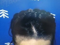 -雍禾植发全国连锁