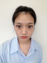 -成都西区医院整形美容