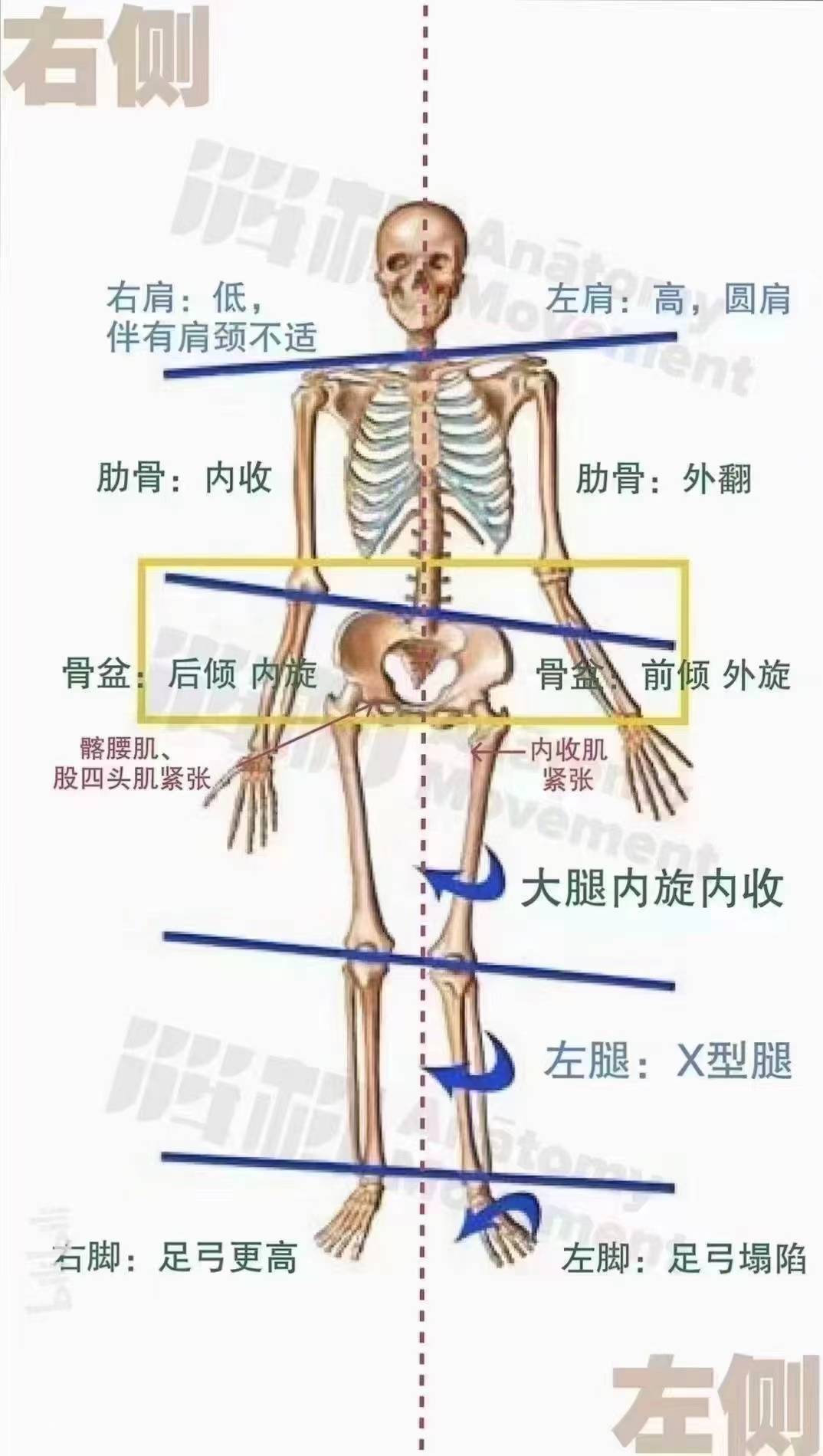 髂腰肌起止点图片