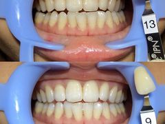 -Dr.Z dental仁康种植矫正中心