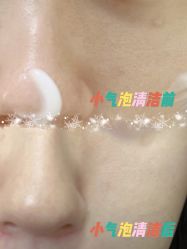 体验前-北京丽星翼美医疗美容