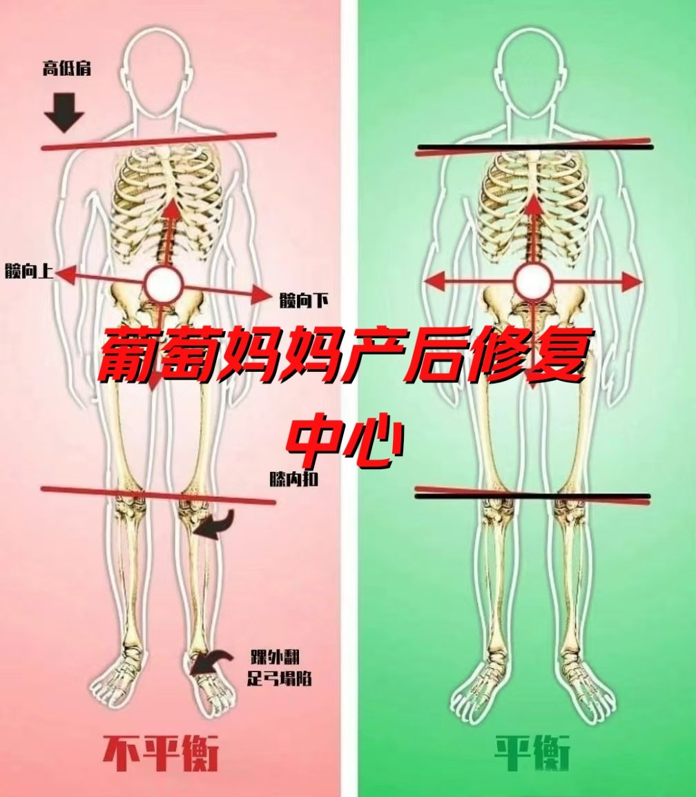 骨盆后倾的危害图片