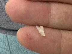 -新甲连锁灰指甲·甲沟炎·鸡眼(黑龙江路店)