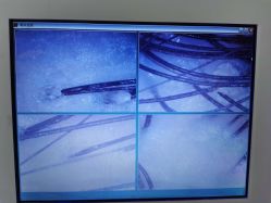 -黑奥秘脱发白发中心