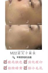 -E.beauty驻颜·痘敏肌调理中心