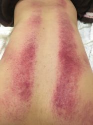 -松和日式美容整骨