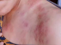 -北京中医药大学东方医院(方庄院区)