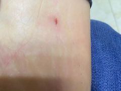 -郑远元专业修脚房·按摩·肉刺·灰指甲(天润城店)