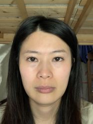 体验前-上海玫瑰医疗美容医院