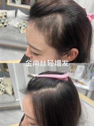 -金尚丝接发