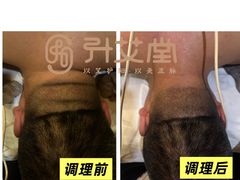 -升艾堂·经络·艾灸·气血(成山路店)