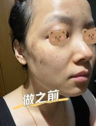 体验前-北京爱育华医院-医疗美容科